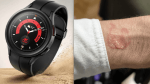 Galaxy Watch 5 Pro Gece Boyunca Aşırı Isınıp Tamamen Boşaldı, Kullanıcının Bileğinde Su Toplanmasına Yol Açtı