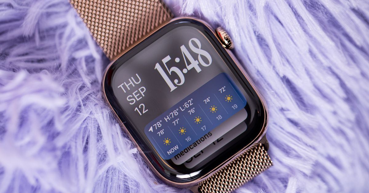 Apple_watch_seri_10