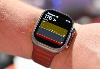 Dexcom G7 ile Şeker Takibi Artık Apple Watch’ta!