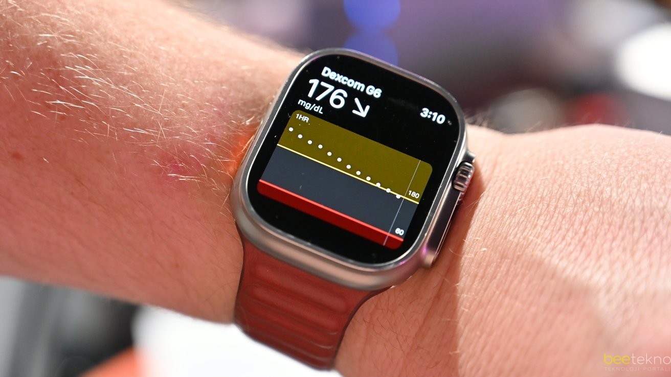 Dexcom G7 ile Şeker Takibi Artık Apple Watch'ta