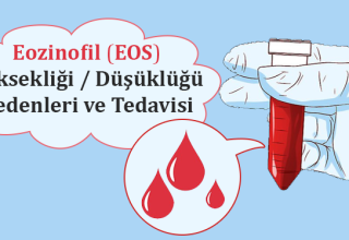 Eozinofil Yüksekliği Nedir?