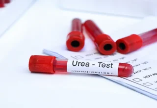 Üre Serum Plazma : Tanımlar, Testler ve Tıbbi Önemi